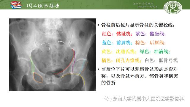 【PPT】骨盆环骨折-骨科医生想获知的内容