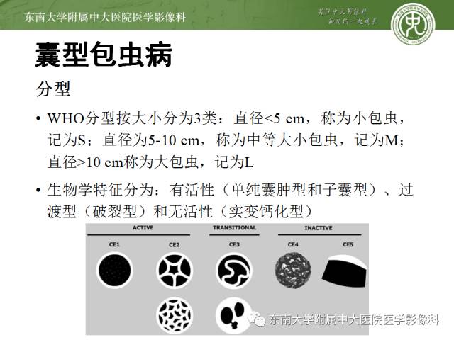 【病例】肝包虫病1例CT影像表现