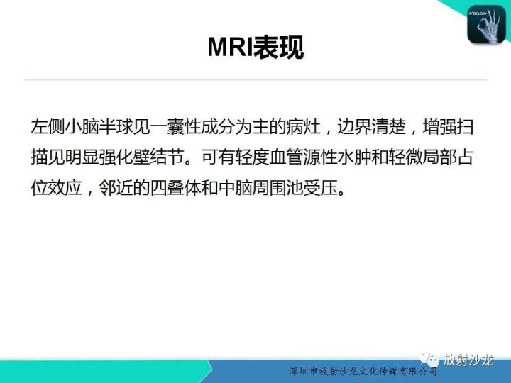 【病例】血管母细胞瘤1例MR