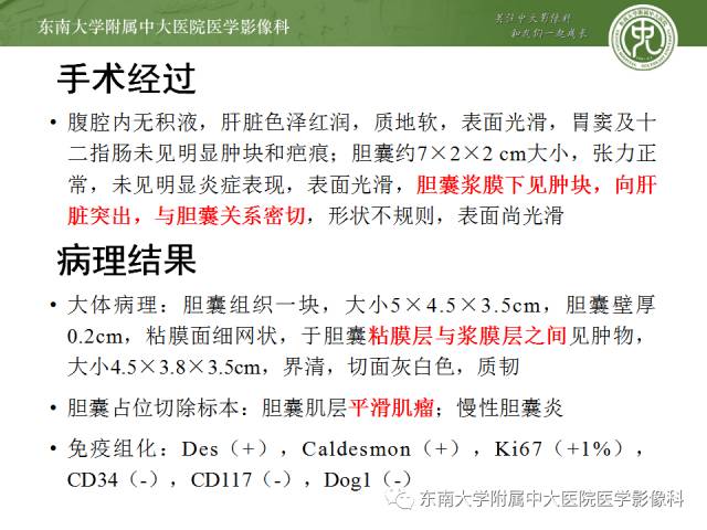 【病例】胆囊平滑肌瘤1例MR