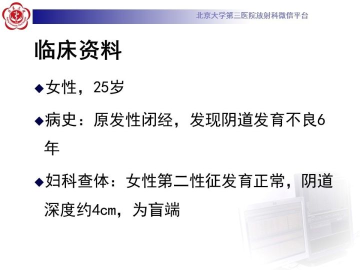 【病例】子宫发育畸形2例MR