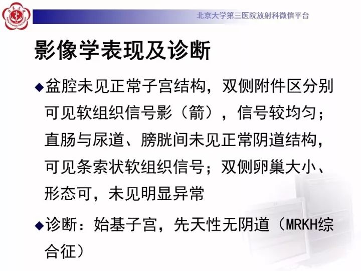 【病例】子宫发育畸形2例MR