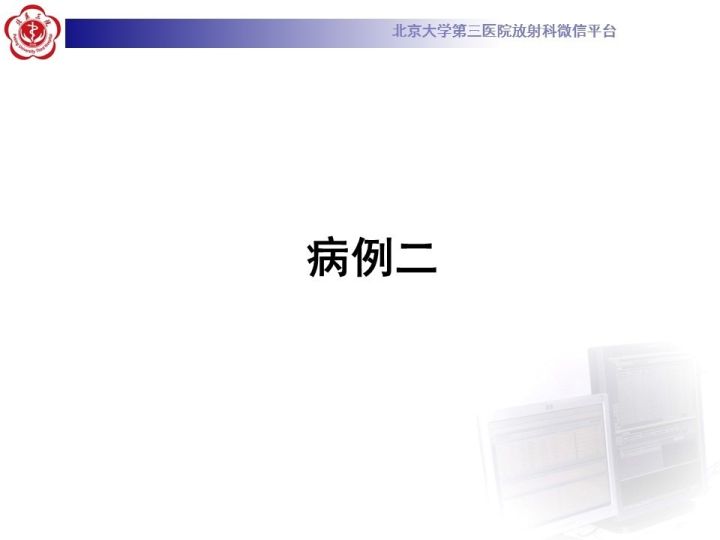 【病例】子宫发育畸形2例MR