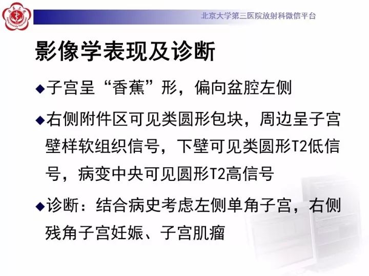 【病例】子宫发育畸形2例MR