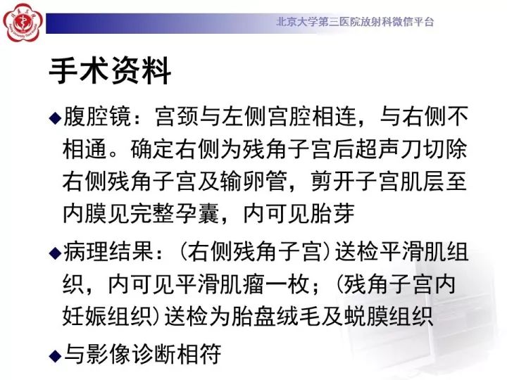 【病例】子宫发育畸形2例MR
