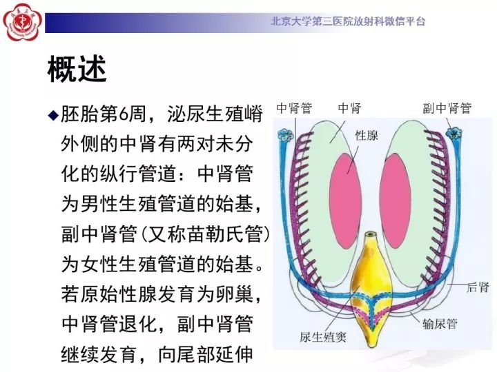 【病例】子宫发育畸形2例MR