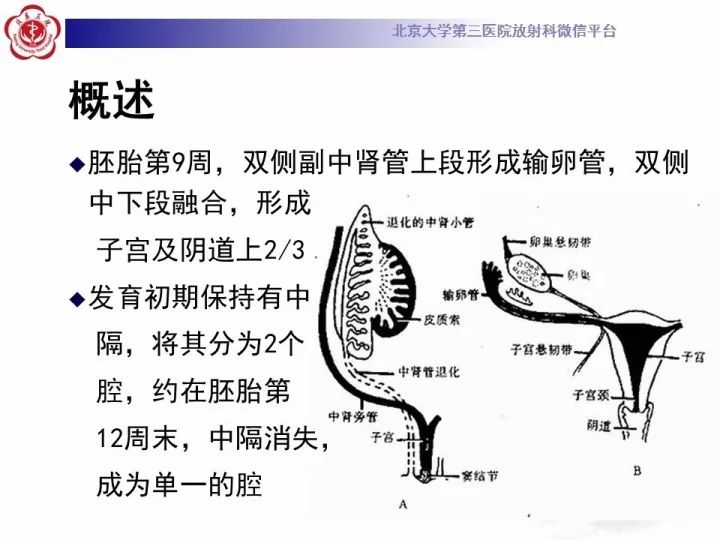 【病例】子宫发育畸形2例MR