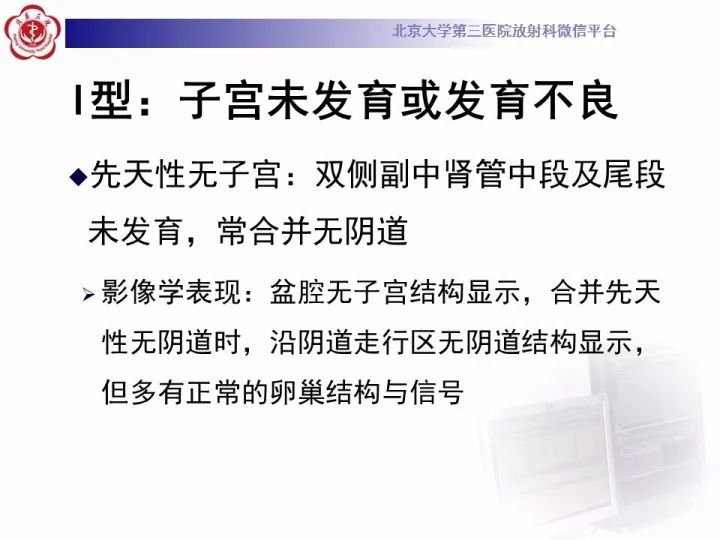 【病例】子宫发育畸形2例MR