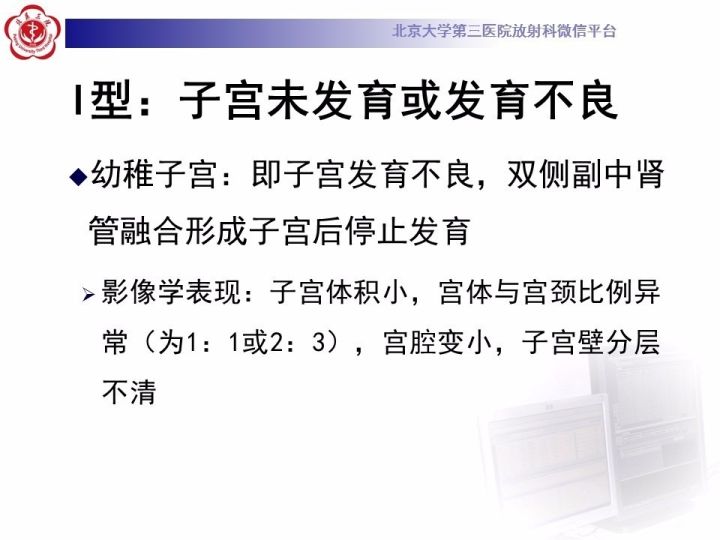 【病例】子宫发育畸形2例MR