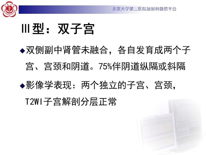 【病例】子宫发育畸形2例MR