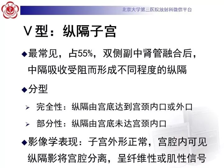 【病例】子宫发育畸形2例MR