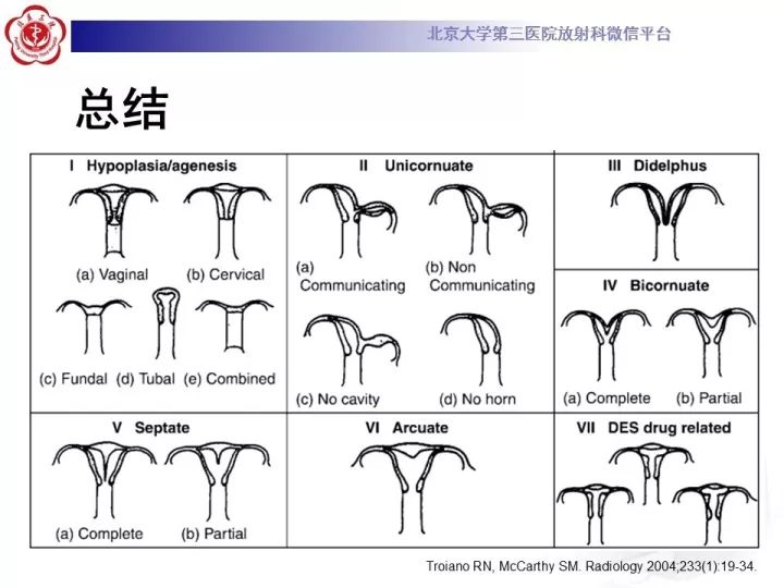 【病例】子宫发育畸形2例MR