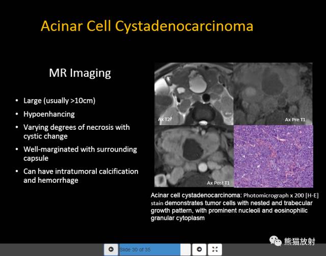 【PPT】胰腺囊性病变的病理分型、MRI表现及鉴别诊断 【PPT】胰腺囊性病变的病理分型、MRI表现及鉴别诊断