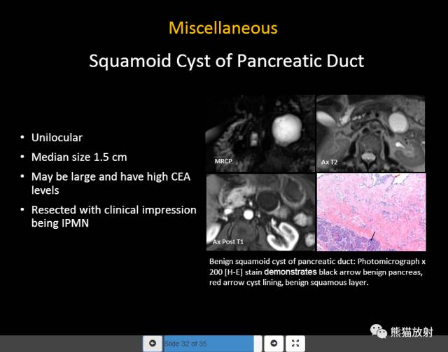【PPT】胰腺囊性病变的病理分型、MRI表现及鉴别诊断 【PPT】胰腺囊性病变的病理分型、MRI表现及鉴别诊断