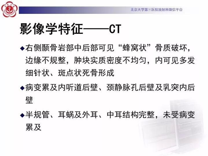 【病例】右侧颞骨内淋巴囊肿瘤1例CT及MR