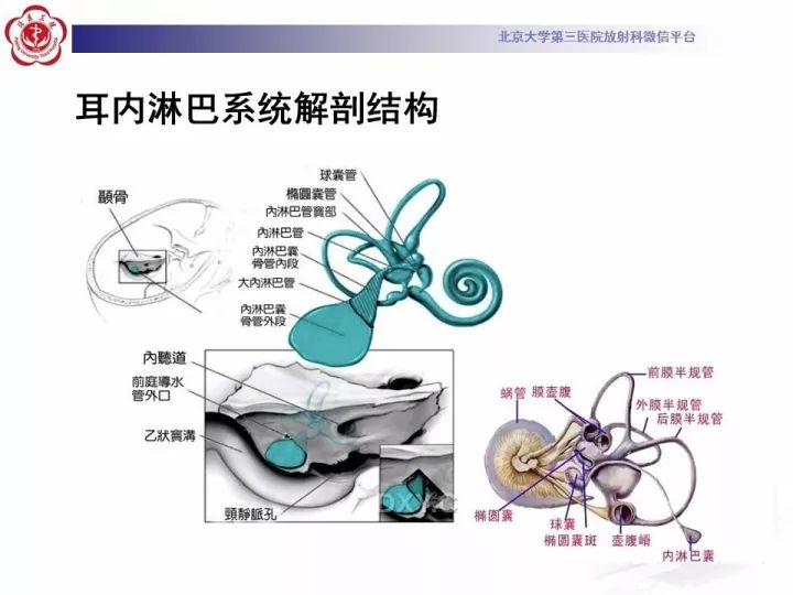 【病例】右侧颞骨内淋巴囊肿瘤1例CT及MR