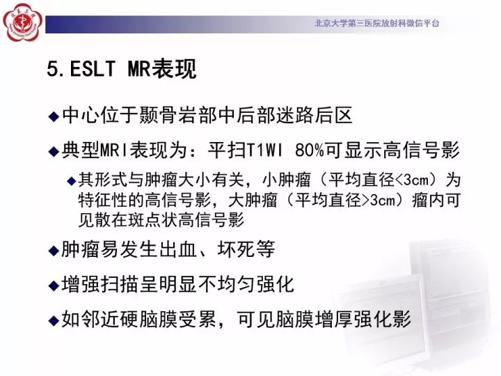 【病例】右侧颞骨内淋巴囊肿瘤1例CT及MR
