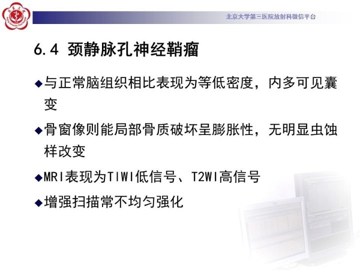 【病例】右侧颞骨内淋巴囊肿瘤1例CT及MR
