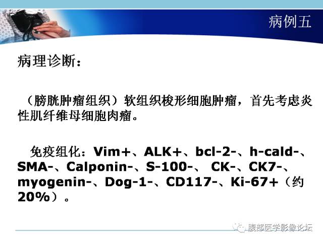 自动草稿 自动草稿