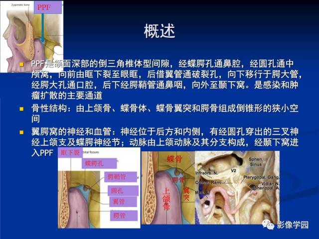 【PPT】翼腭窝PPF的解剖及影像学评价
