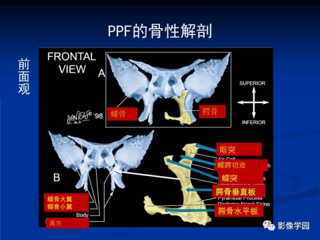 【PPT】翼腭窝PPF的解剖及影像学评价
