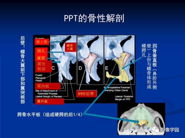 【PPT】翼腭窝PPF的解剖及影像学评价