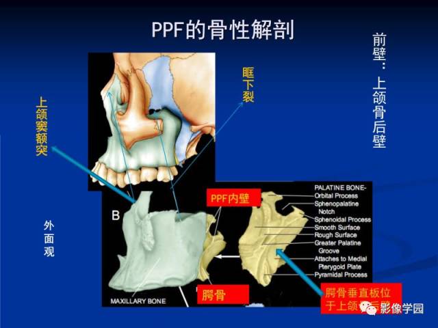 【PPT】翼腭窝PPF的解剖及影像学评价