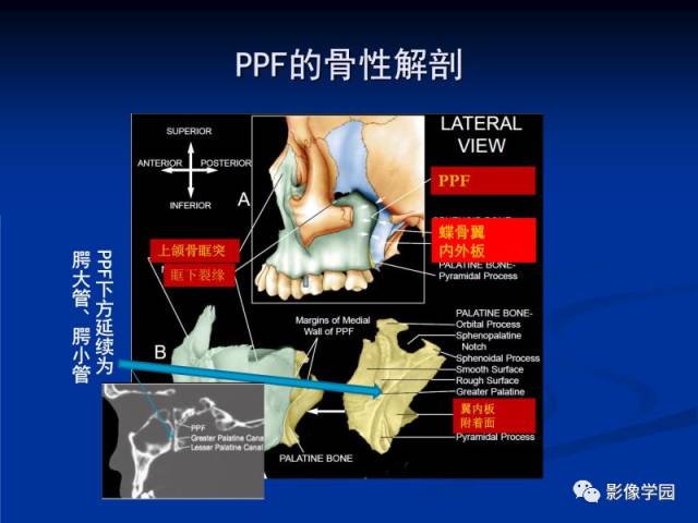 【PPT】翼腭窝PPF的解剖及影像学评价