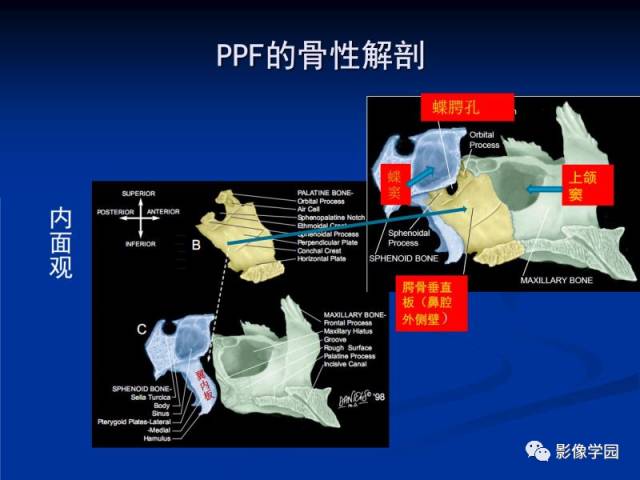 【PPT】翼腭窝PPF的解剖及影像学评价