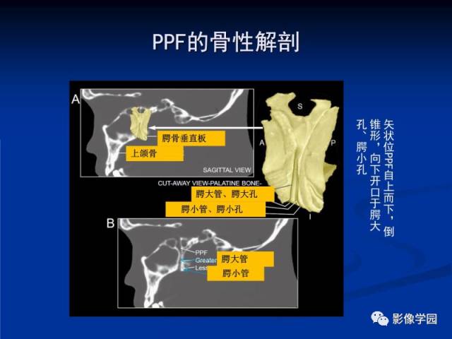 【PPT】翼腭窝PPF的解剖及影像学评价