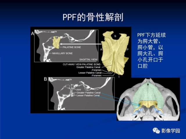【PPT】翼腭窝PPF的解剖及影像学评价