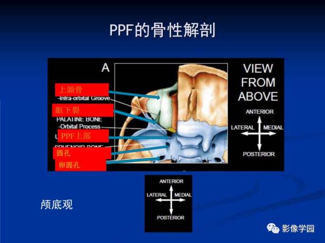 【PPT】翼腭窝PPF的解剖及影像学评价