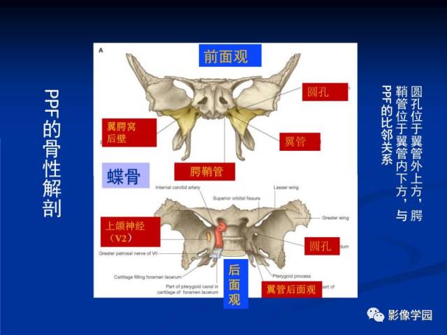 【PPT】翼腭窝PPF的解剖及影像学评价