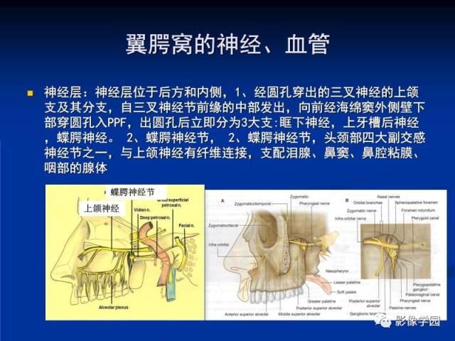 【PPT】翼腭窝PPF的解剖及影像学评价