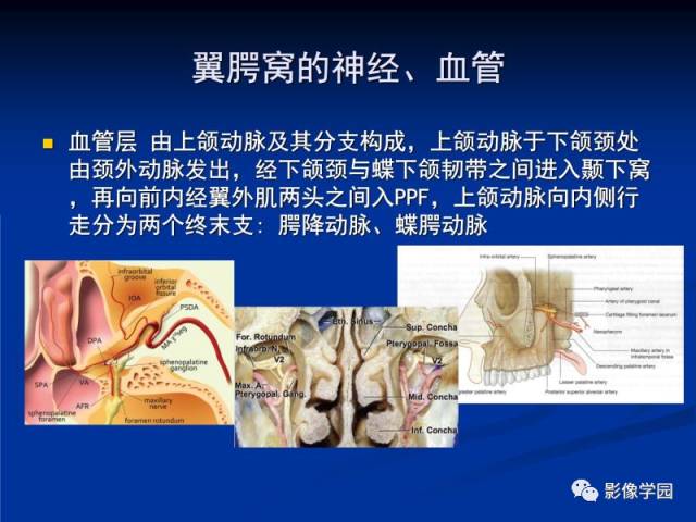 【PPT】翼腭窝PPF的解剖及影像学评价