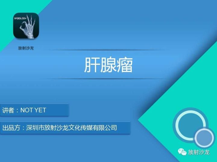 【病例】肝腺瘤1例MR