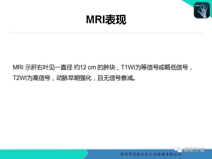 【病例】肝腺瘤1例MR