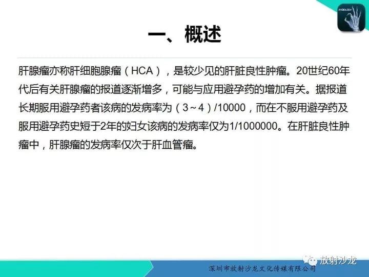 【病例】肝腺瘤1例MR