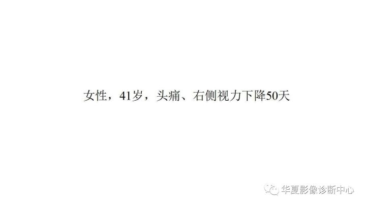 【病例】鞍旁硬膜型海绵状血管瘤1例MR