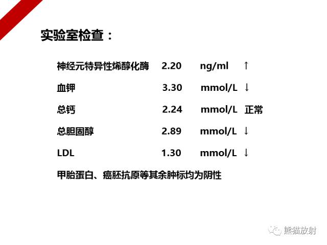 【病例】骨化性肌炎1例X线PET-CT及MR