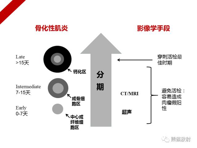 【病例】骨化性肌炎1例X线PET-CT及MR