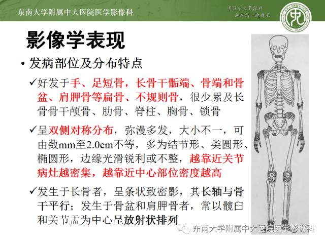 【病例】骨斑点症1例CT