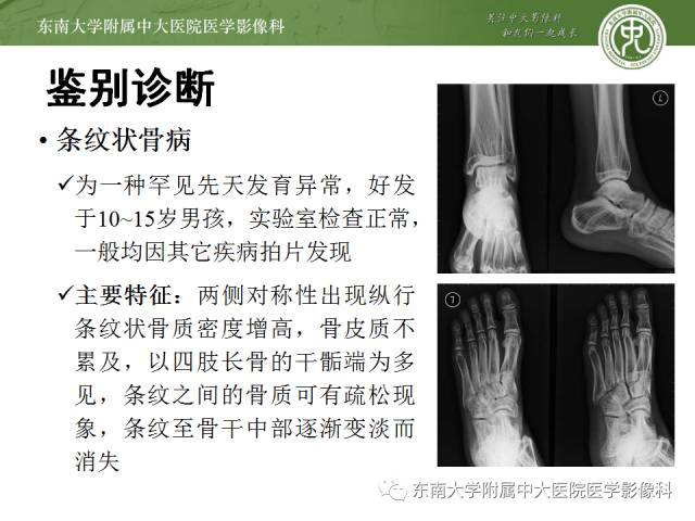 【病例】骨斑点症1例CT