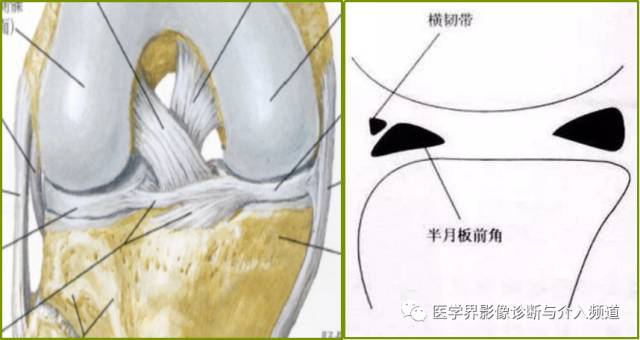 容易误诊为半月板损伤的11种结构 容易误诊为半月板损伤的11种结构