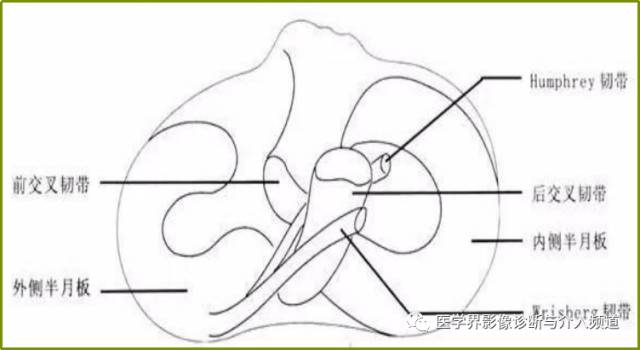 容易误诊为半月板损伤的11种结构 容易误诊为半月板损伤的11种结构