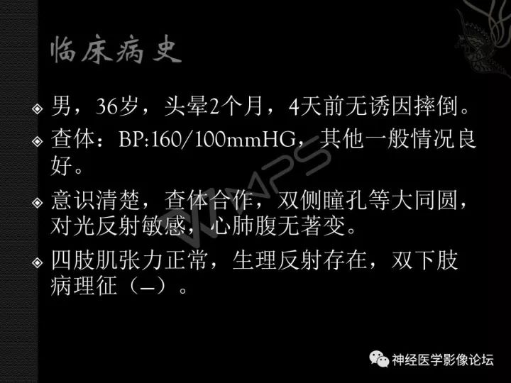 【病例】菊形团形成性胶质神经元肿瘤1例CT及MR表现 【病例】菊形团形成性胶质神经元肿瘤1例CT及MR表现