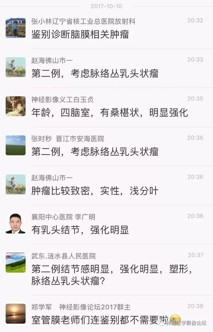 【病例】四脑室脉络丛乳头状瘤一例MR