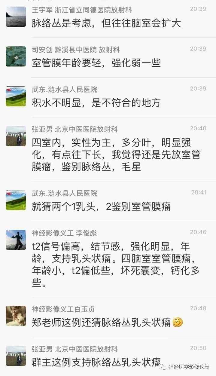 【病例】四脑室脉络丛乳头状瘤一例MR