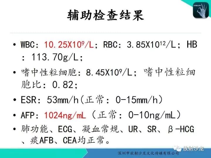 【病例】纵隔卵黄囊瘤1例CT影像表现