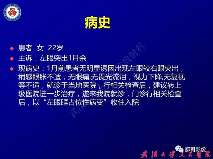 【病例】眼眶淋巴管瘤1例MR影像诊断